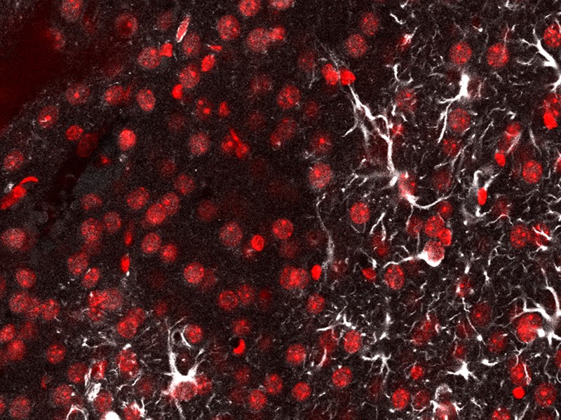 Desarrollan una sonda de luz que detecta metástasis cerebral en ratones